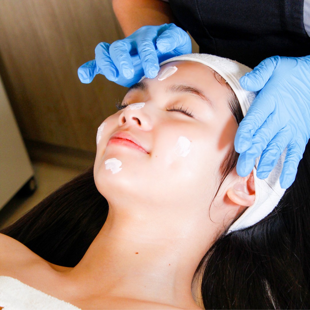 Acne Facial