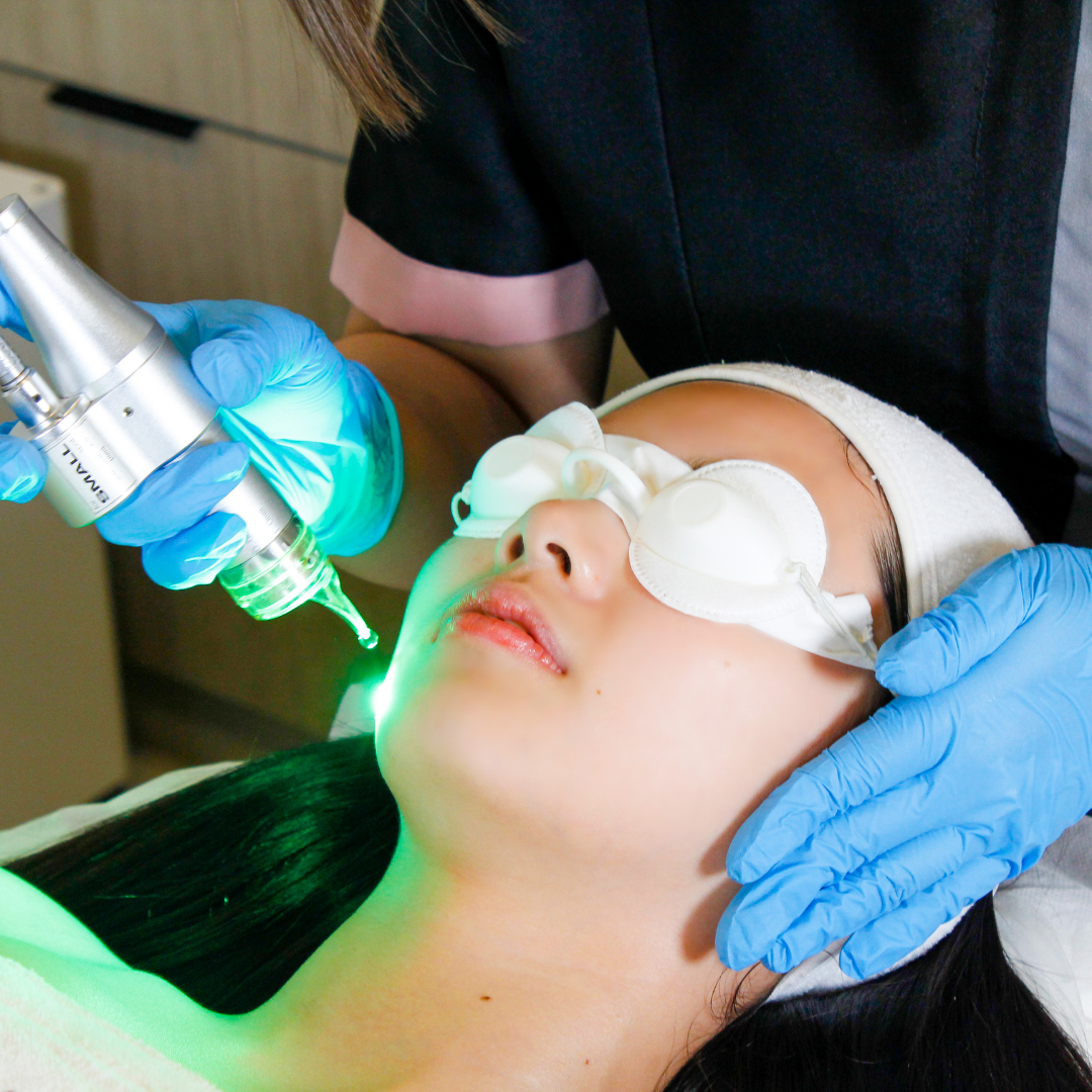 Signature Calming Laser Facial